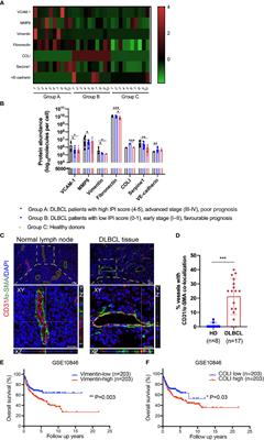 Diffuse Large B-Cell Lymphoma Promotes <mark class="highlighted">Endothelial-to-Mesenchymal Transition</mark> via WNT10A/Beta-Catenin/Snail Signaling